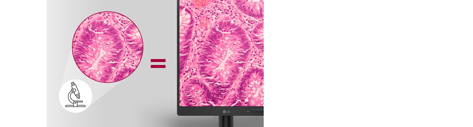 Pathology Mode (Način rada za patologiju) omogućuje rezultate snimanja koji sadržavaju jednake pojedinosti i preciznost boja kao i slika koju gledate na mikroskopu.