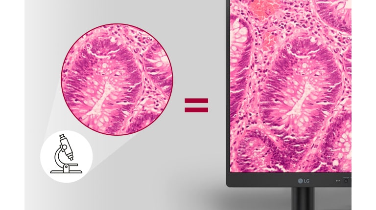 Pathology Mode (Način rada za patologiju) omogućuje rezultate snimanja koji sadržavaju jednake pojedinosti i preciznost boja kao i slika koju gledate na mikroskopu.