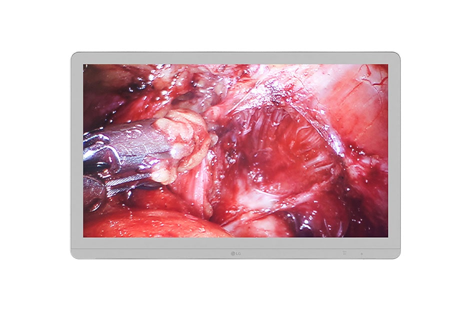 LG 27 '' LG 8MP kirurški monitor, 27HJ710S-W, thumbnail 2