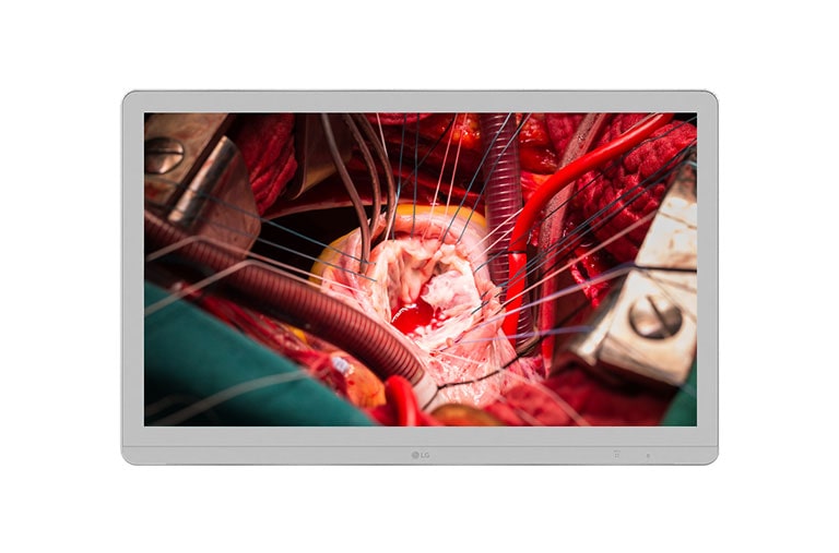 LG 27 '' LG 8MP kirurški monitor, 27HJ710S-W, thumbnail 1