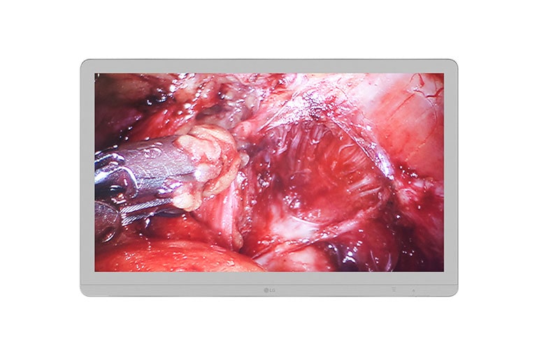 LG 27 '' LG 8MP kirurški monitor, 27HJ710S-W, thumbnail 2
