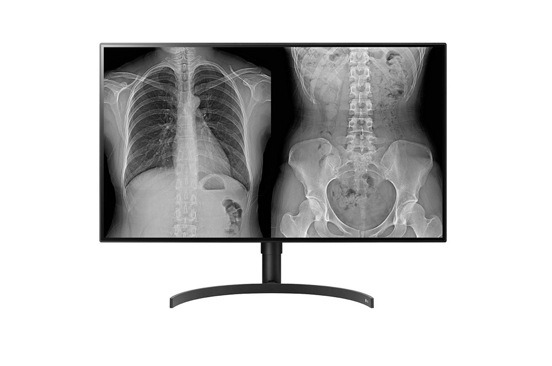 LG 31,5'' 8 MP-es diagnosztikai monitor, 32HL512D-B