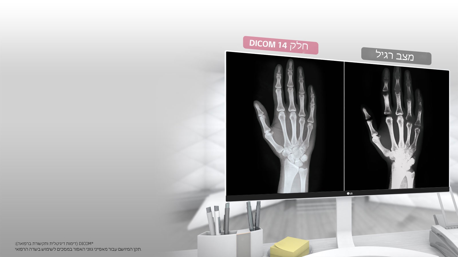 DICOM חלק 14<br>1