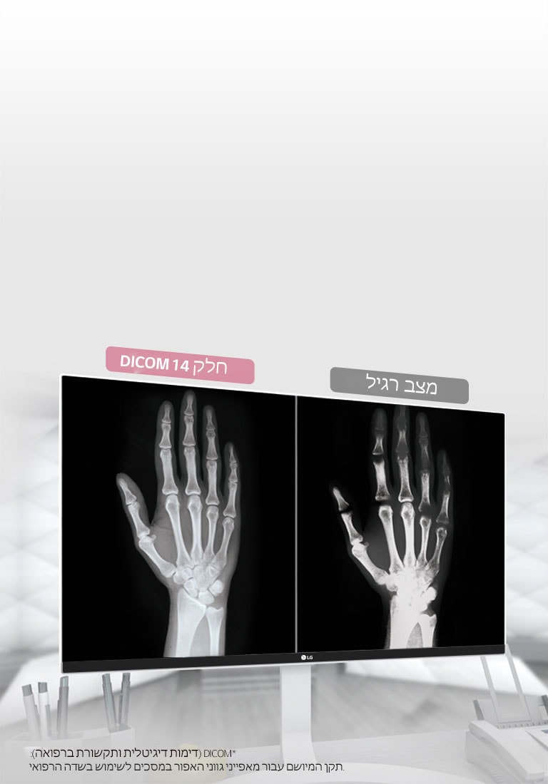 DICOM חלק 14<br>2