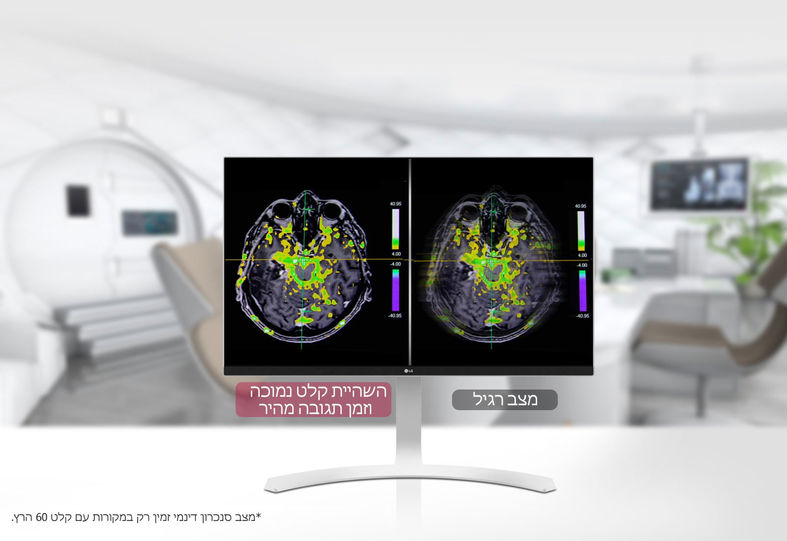 מצב סנכרון דינמי וזמן תגובה מהיר <br>1