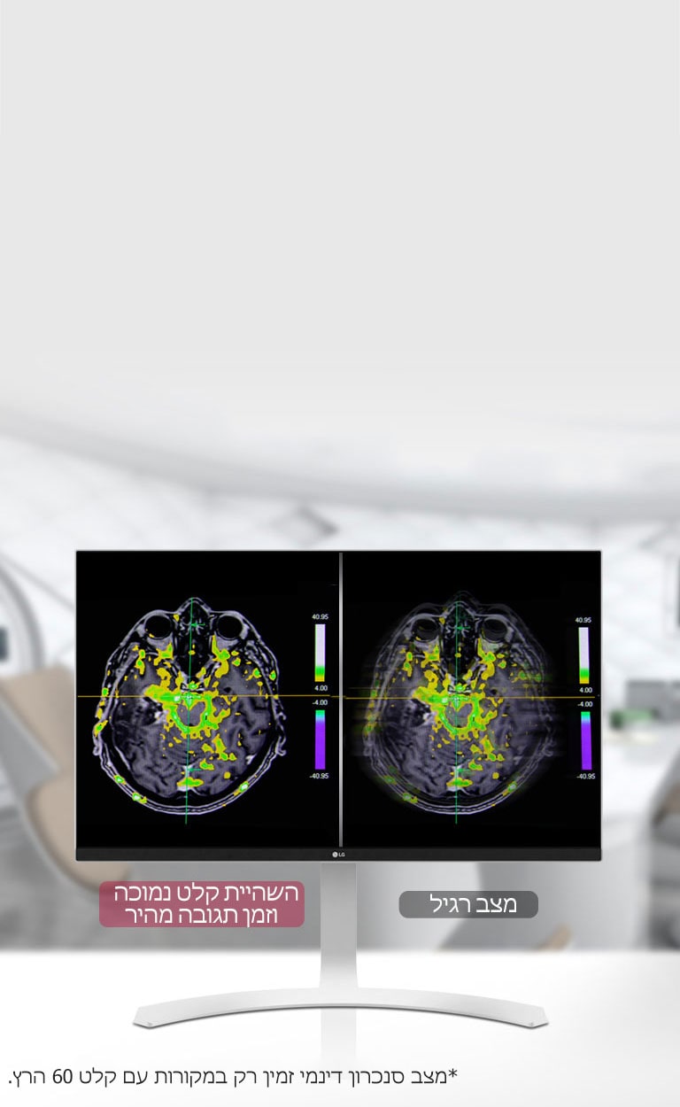מצב סנכרון דינמי וזמן תגובה מהיר <br>2