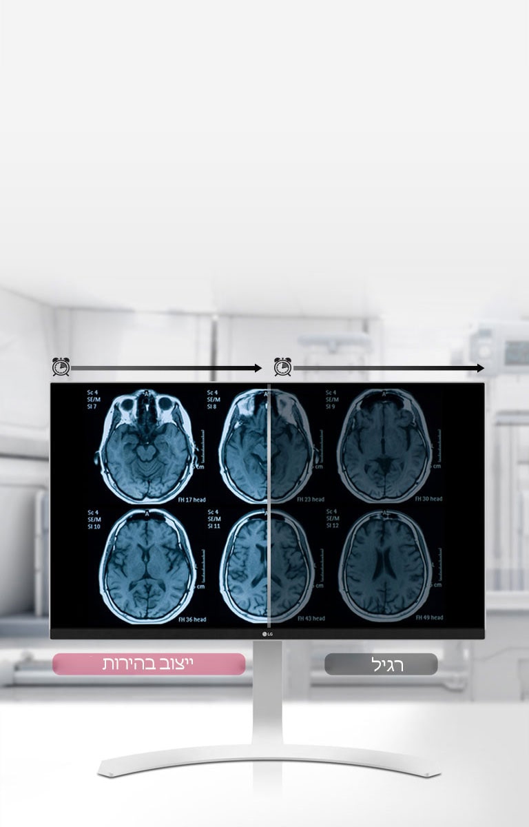 ייצוב בהירות<br>2