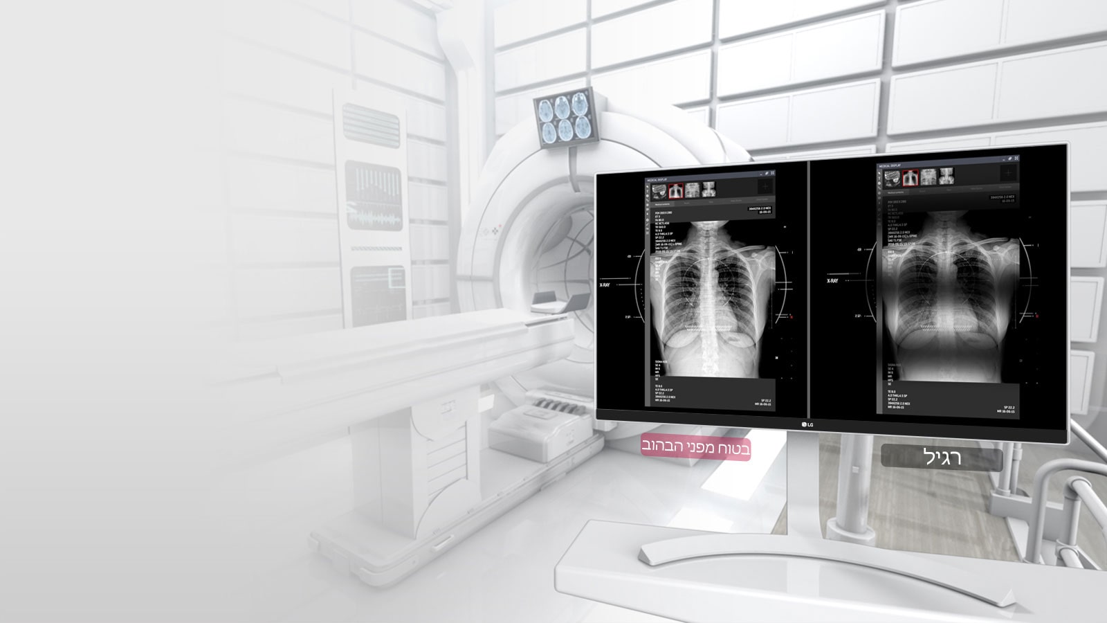 בטוח מפני הבהוב<br>1