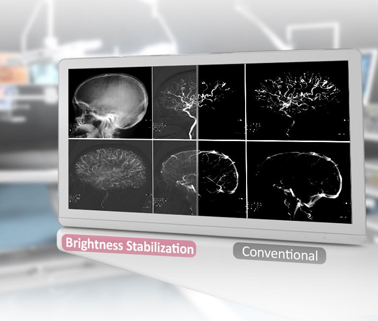 מצב סנכרון דינמי וזמן תגובה מהיר<br>2