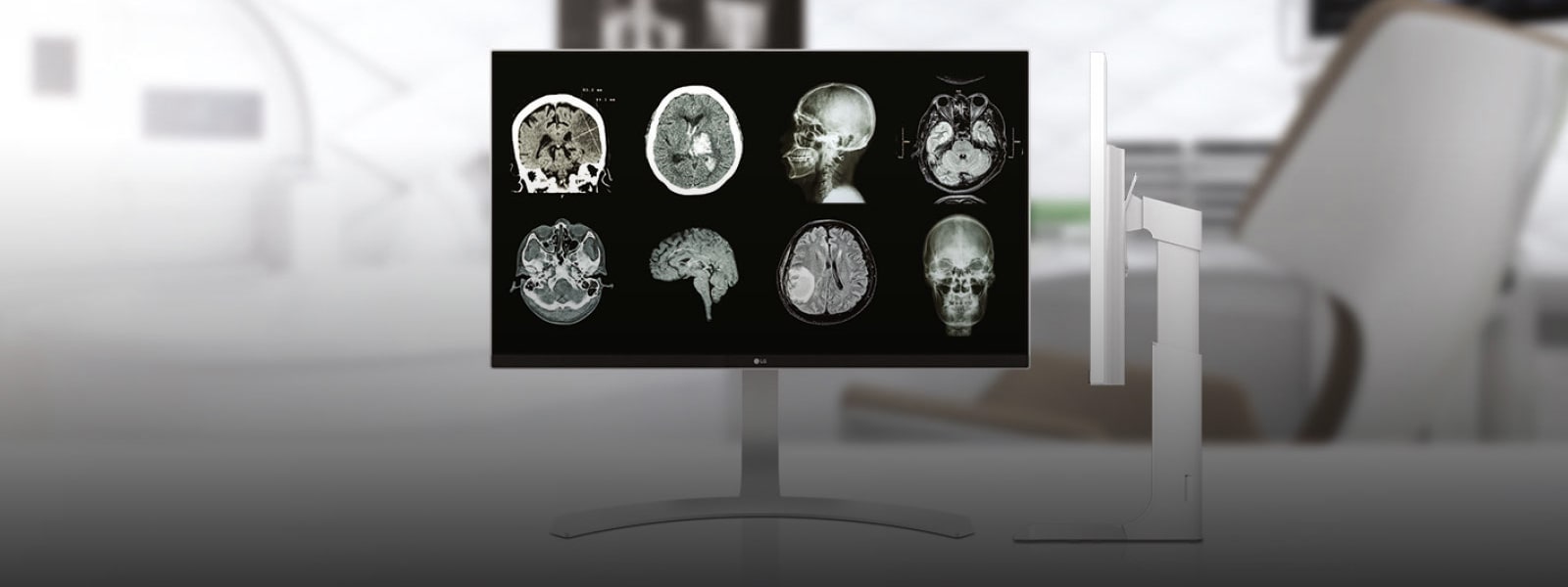 מסכי מחשב רפואיים1