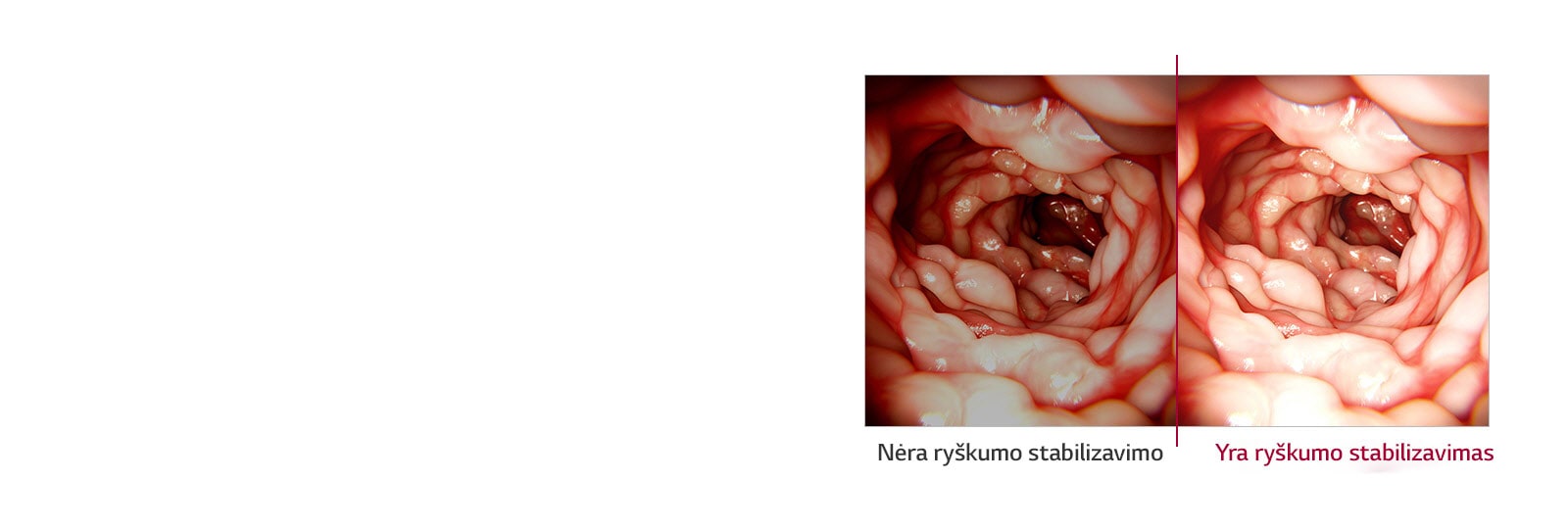 Ryškumo stabilizavimas