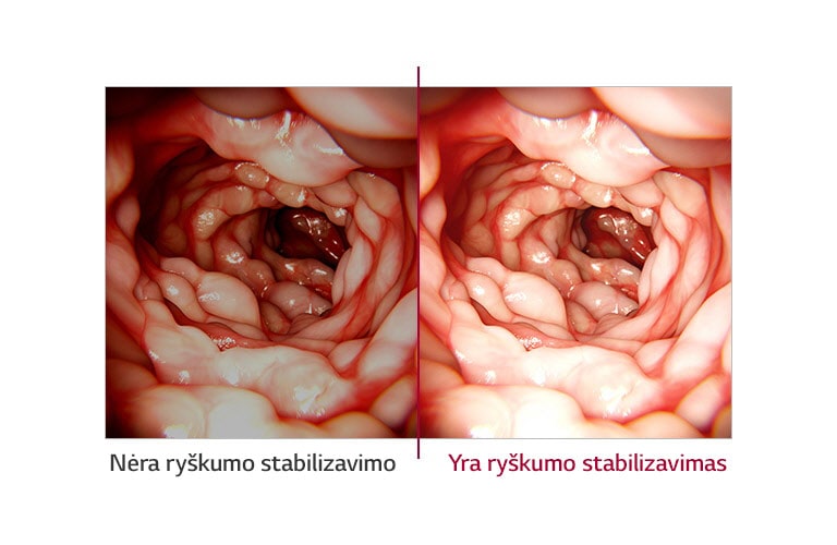 Ryškumo stabilizavimas