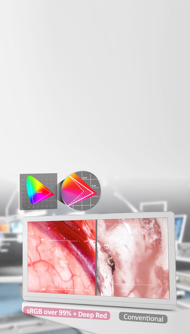 IPS ir „sRGB virš 99% + „Deep RED<br>2