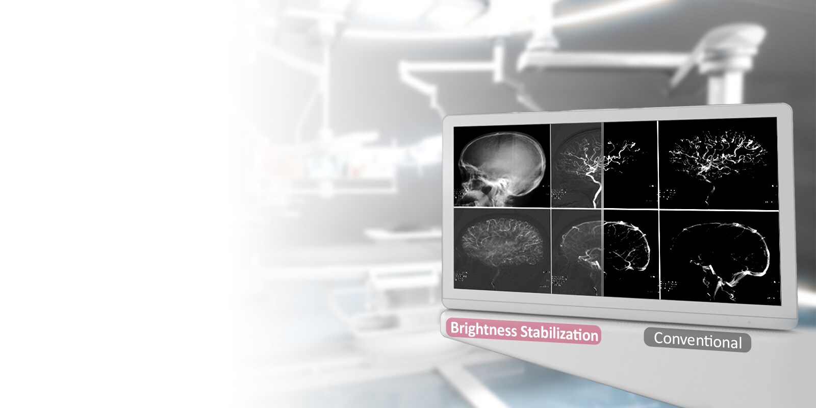 DICOM 14 dalis ir ryškumo stabilizavimas<br>1