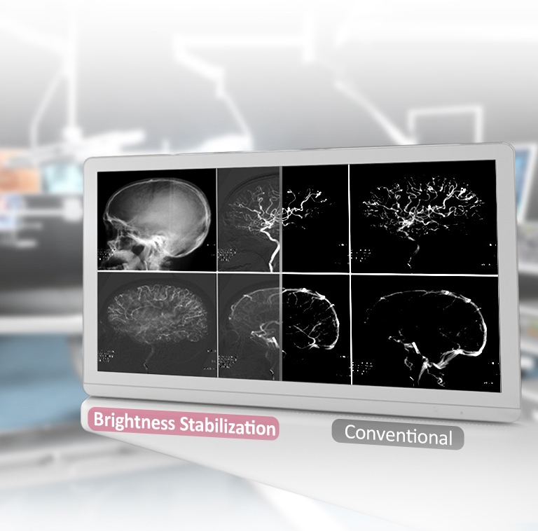 DICOM 14 dalis ir ryškumo stabilizavimas<br>2