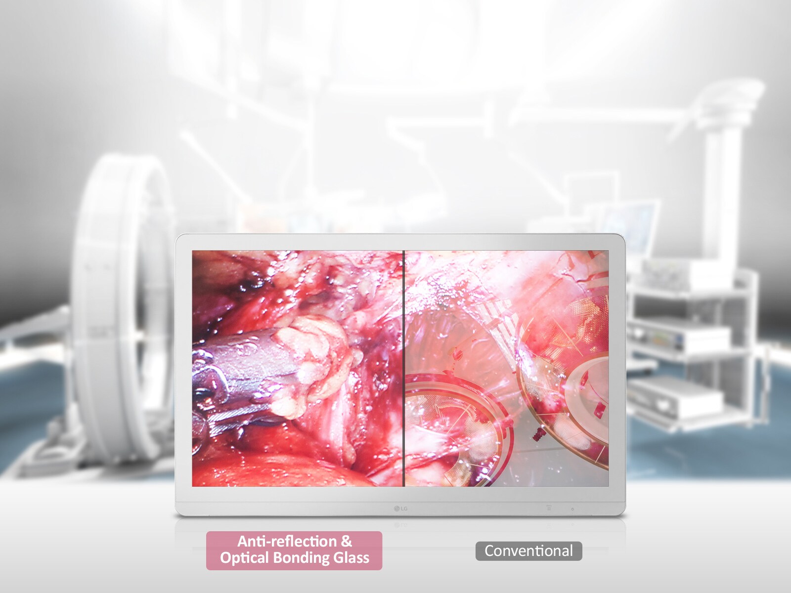 Neatspindintis ir kokybiškai priklijuotas stiklas 1