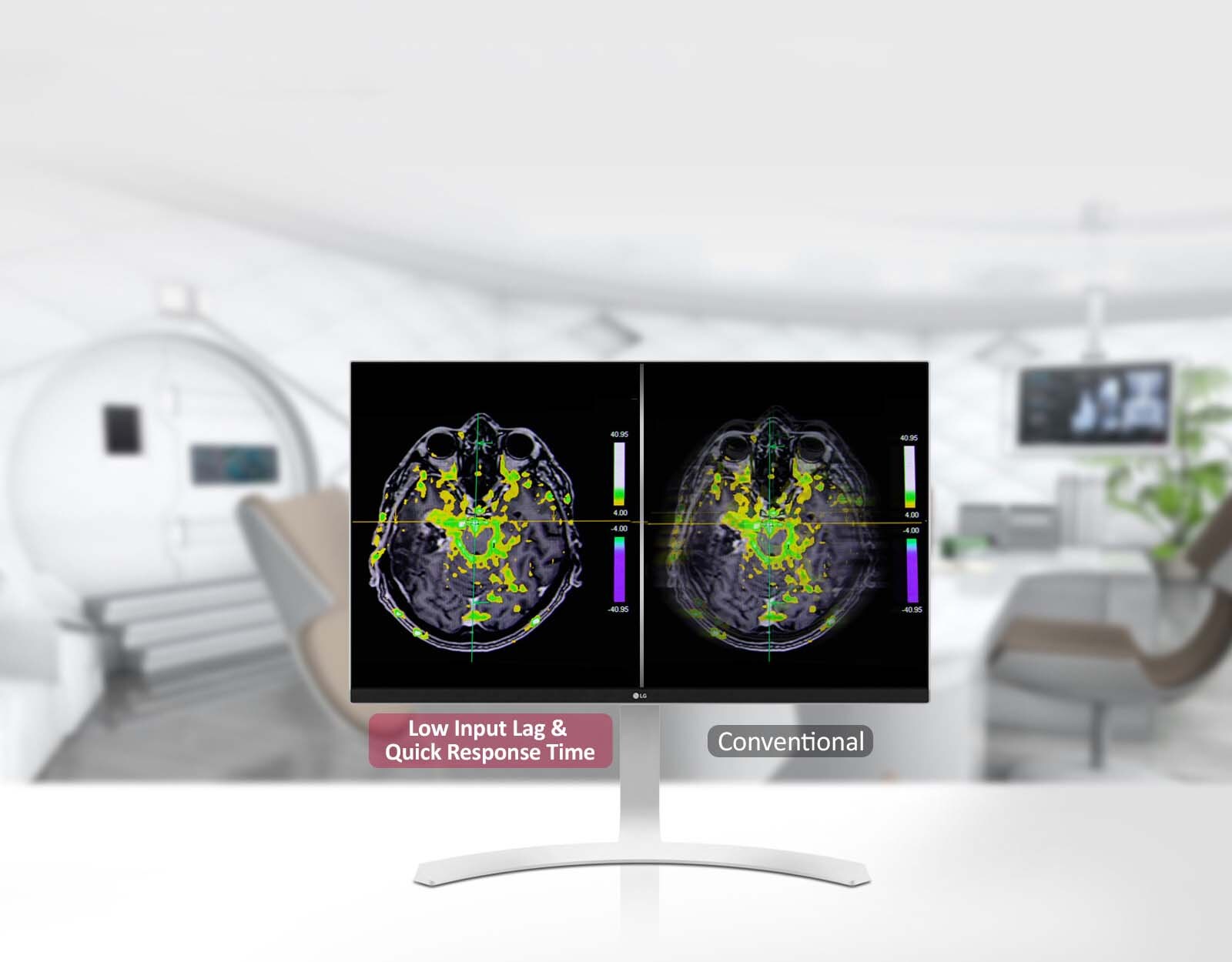 Dinaminio sinchr. rež., trumpas reakcijos laikas 1