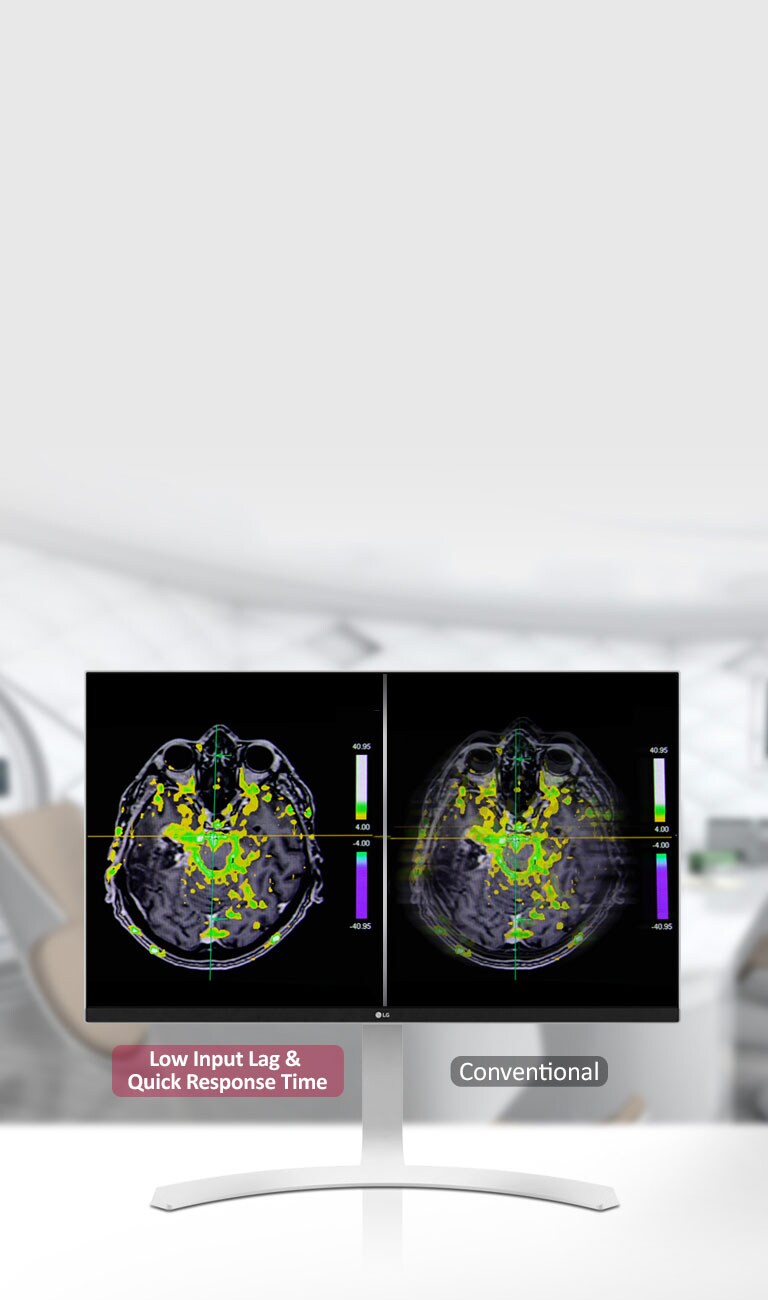 Dinaminio sinchr. rež., trumpas reakcijos laikas 2