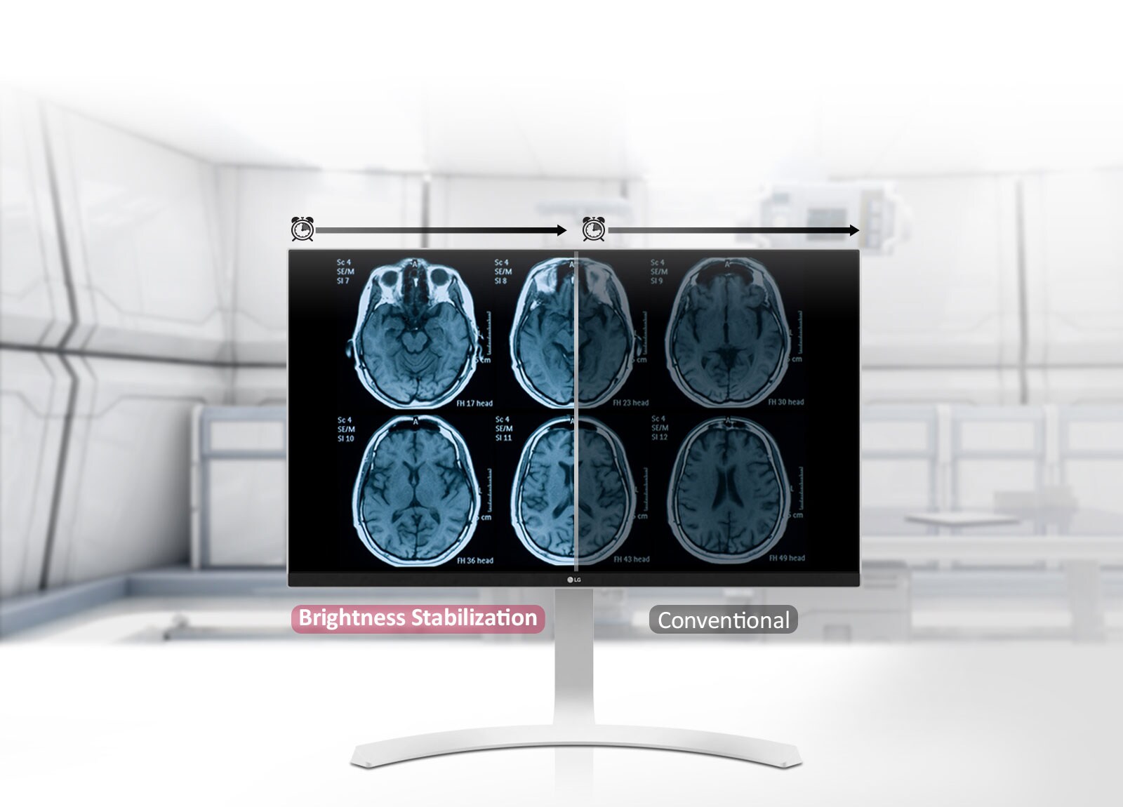 Ryškumo stabilizavimas <br>1