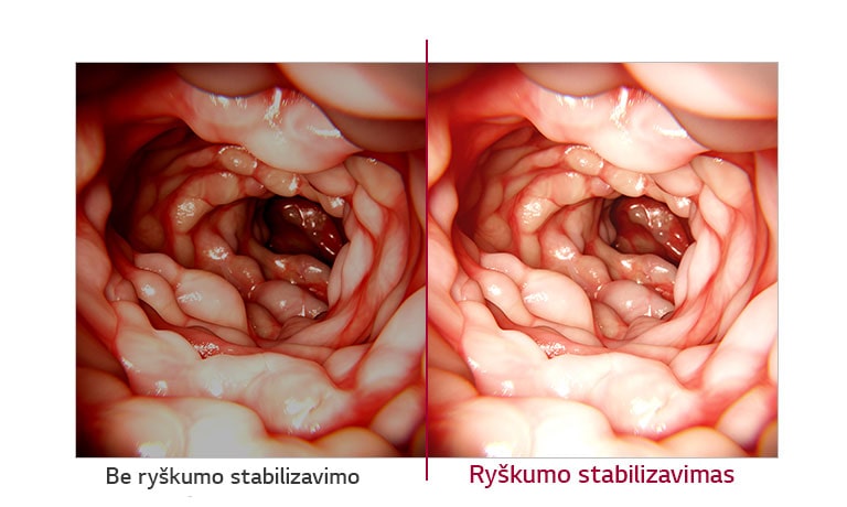 Be ryškumo stabilizavimo ir Ryškumo stabilizavimas 