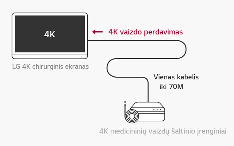 12G-SDI palaikymas: LG 4K chirurginis ekranas užtikrina 4K signalų perdavimą dideliu atstumu vienu koaksialiniu kabeliu be vėlavimo, kad operacija būtų stabili. 