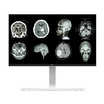 27” Medicininis monitorius 4K 1