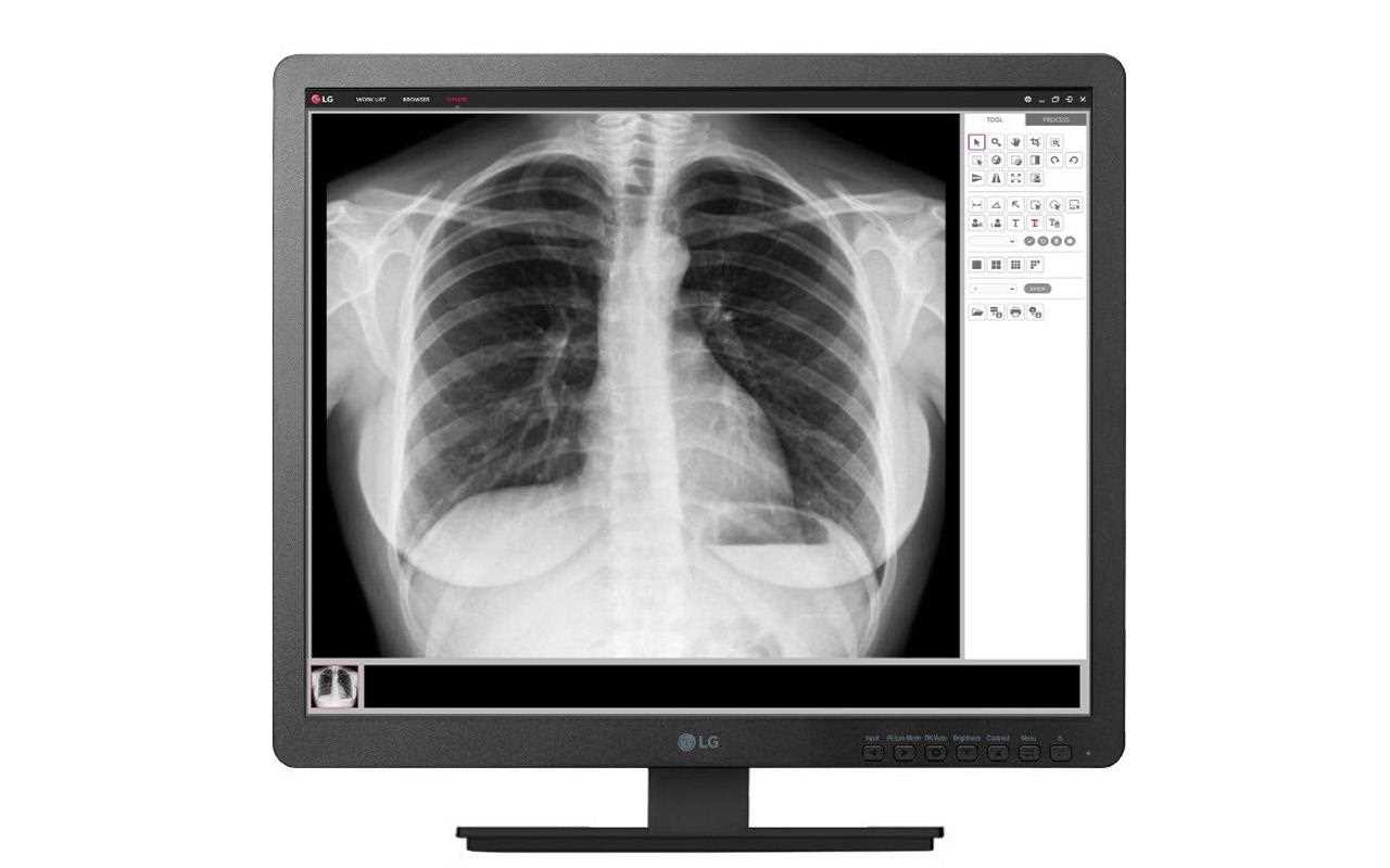 LG 19HK312C monitorius