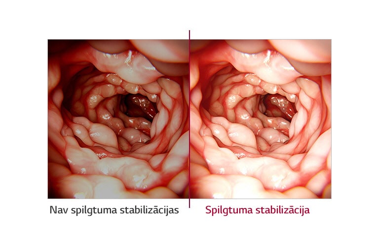 Spilgtuma stabilizācija