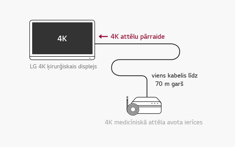 12G-SDI atbalsts: LG 4K ķirurģiskais displejs nodrošina 4K signālu tālsatiksmes pārraidi pa vienu koaksiālo kabeli bez latentuma, lai nodrošinātu stabilu operāciju. 