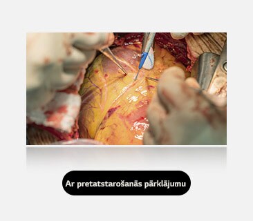 Labajā attēlā ar pretatstarošanās pārklājumu ir nodrošināts skaidrāks skats ar samazinātu spīdumu.