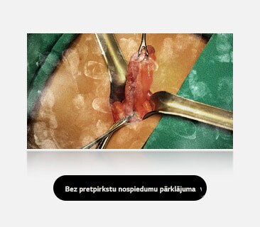 Kreisajā attēlā redzams displejs ar redzamiem pirkstu nospiedumiem un traipumiem, kas aizēno skatu.