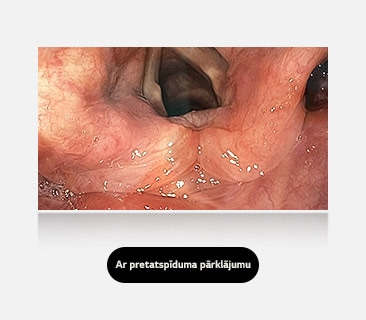 Labajā attēlā ar pretatspīduma pārklājumu redzams skaidrs un netraucēts skats, kas apliecina pārklājuma efektivitāti.
