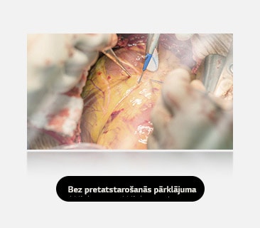Kreisajā attēlā redzams displejs bez pretatstarošanās pārklājuma, kurā pastiprināts spīdums un atspulgi ietekmē redzamību.
