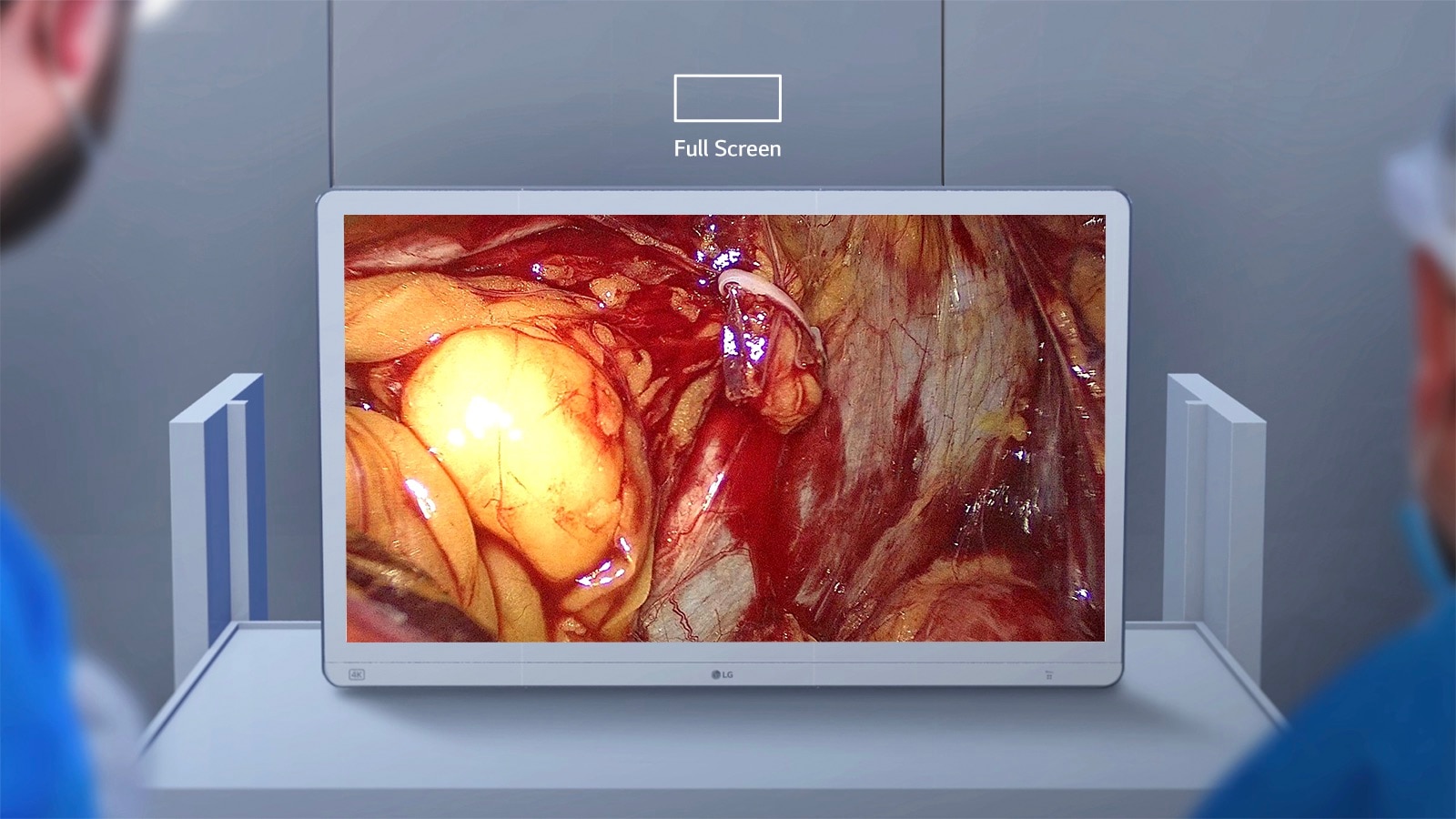 Video redzams medicīniskais monitors, kurā vienlaikus tiek attēlota līdz pat četru dažādu veidu informācija, uzlabojot darbības efektivitāti un lēmumu pieņemšanu.