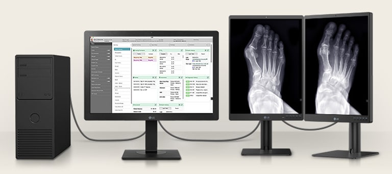 Varat savienot 24HR513C ar diviem *3MP diagnostikas monitoriem, kas parāda pacientu diagrammas uz 24HR513C un medicīniskos attēlus divos 3MP monitoros.