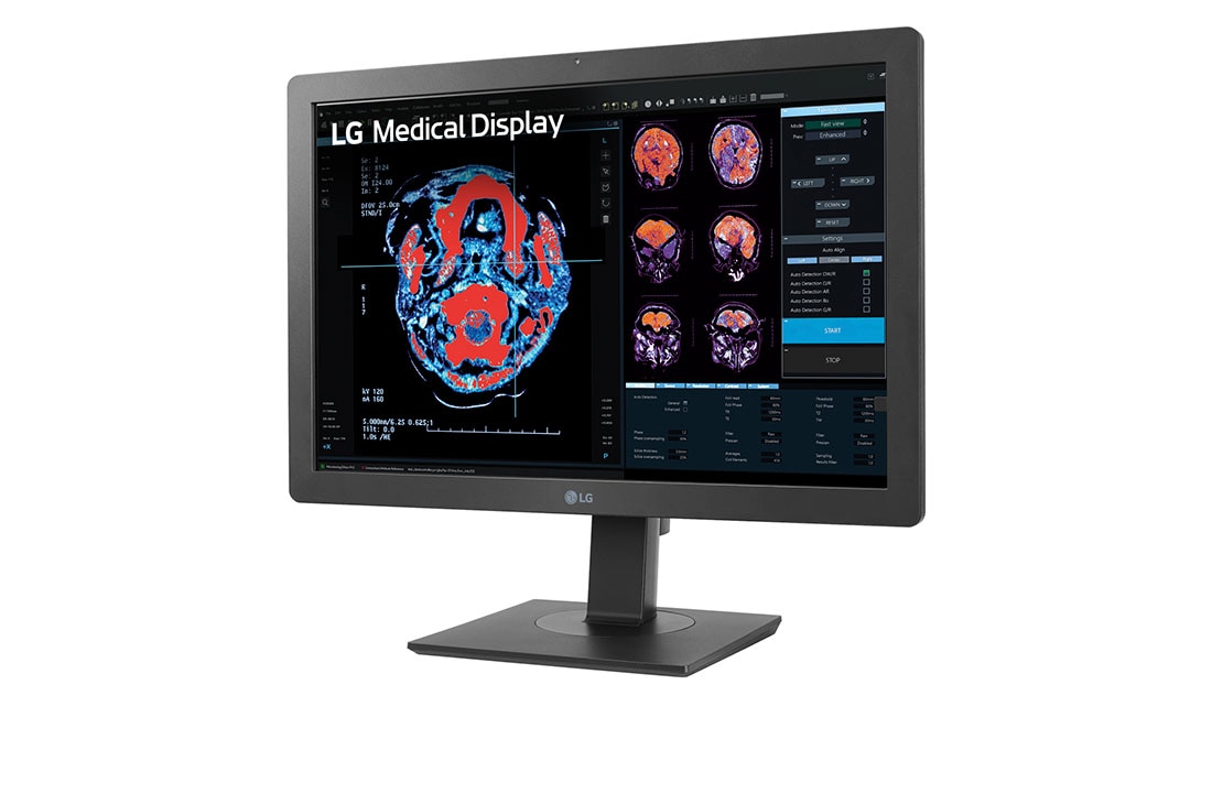 LG 24” 2MP IPS klīniskās apskates monitors, sānu skats -15&nbsp;grādu leņķī, 24HR513C-B, thumbnail 2