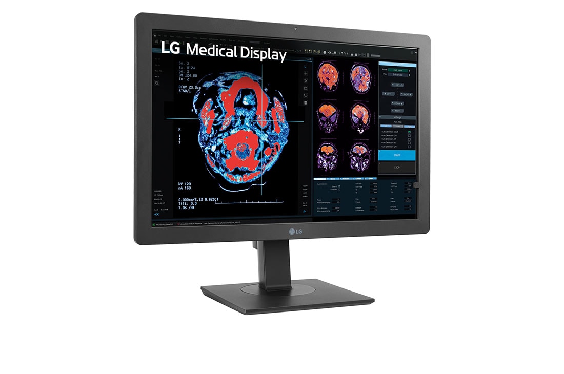 LG 24” 2MP IPS klīniskās apskates monitors, sānu skats +15&nbsp;grādu leņķī, 24HR513C-B, thumbnail 3