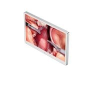 LG 32&nbsp;collu 4K ķirurģiskais monitors, skats no kreisās puses, 32HS710S-W, thumbnail 4