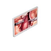 LG 32&nbsp;collu 4K ķirurģiskais monitors, skats no labās puses, 32HS710S-W, thumbnail 5