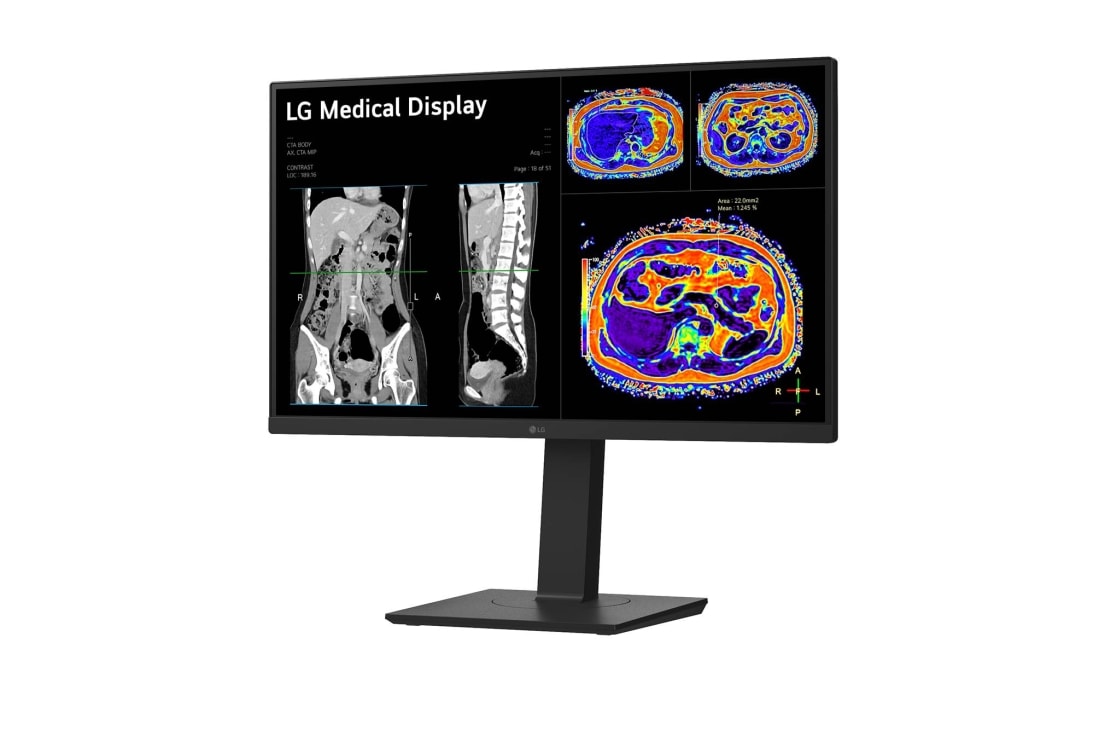 LG 27” 8MP IPS klīniskās apskates monitors, sānu skats -15&nbsp;grādu leņķī, 27HS713C-B, thumbnail 2