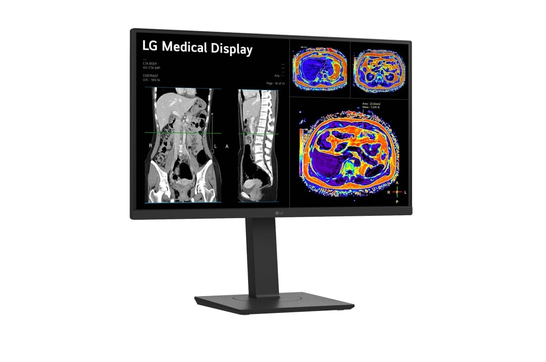 LG 27” 8MP IPS klīniskās apskates monitors, sānu skats +15&nbsp;grādu leņķī, 27HS713C-B, thumbnail 3