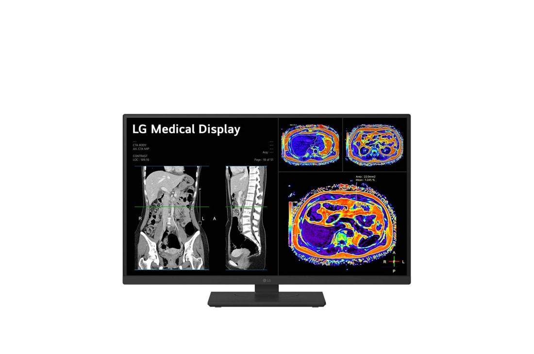 LG 27” 8MP IPS klīniskās apskates monitors, skats no priekšpuses zemā pozīcijā, 27HS713C-B, thumbnail 4