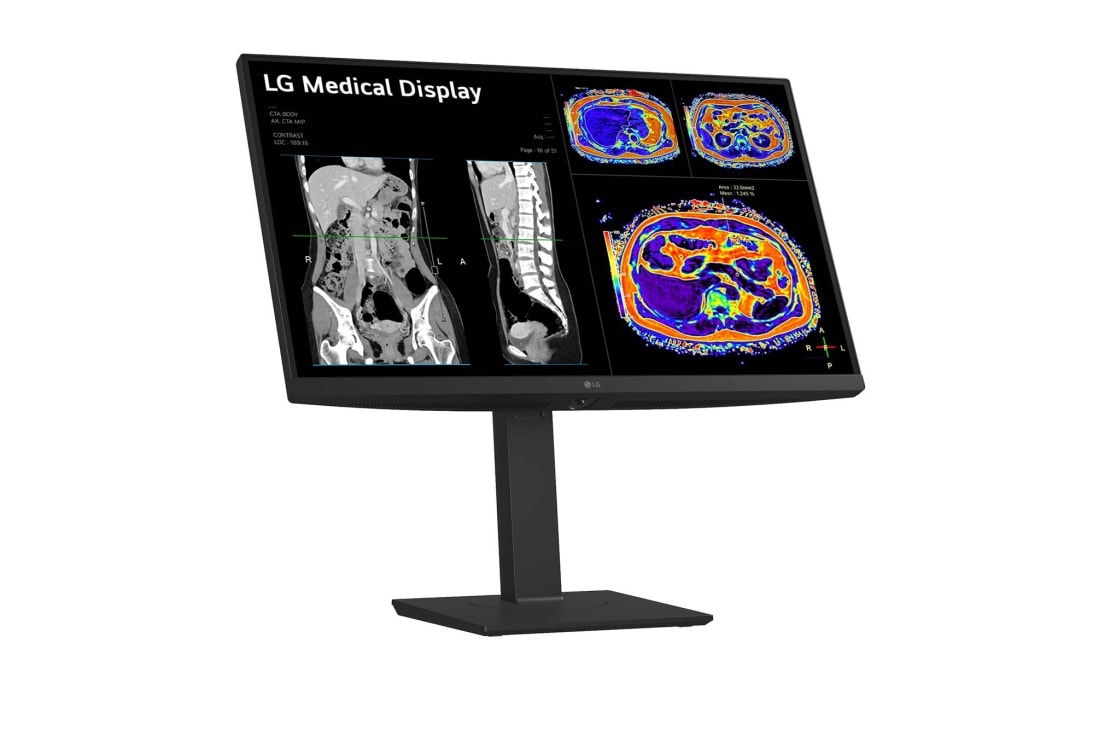 LG 27” 8MP IPS klīniskās apskates monitors, sānu skats +15&nbsp;grādu leņķī ar slīpumu, 27HS713C-B, thumbnail 5