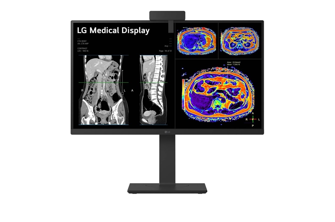 LG 27” 8MP IPS klīniskās apskates monitors, skats no sāna -15 grādu leņķī ar kalibrēšanas sensoru, 27HS713C-B, thumbnail 15