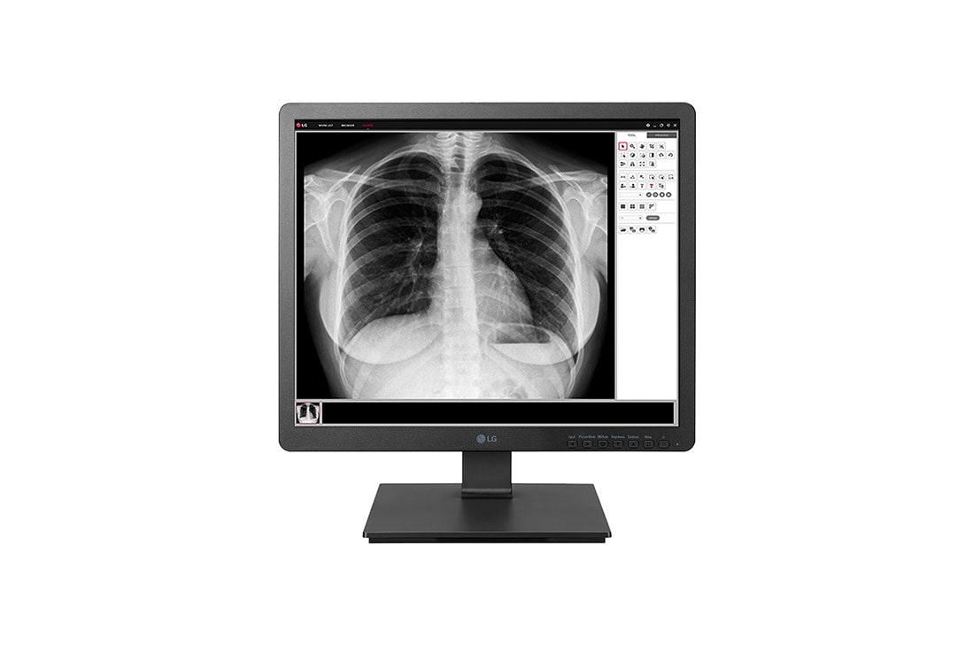 LG 19 Inch medische monitor 1280 x 1024, 19HK312C