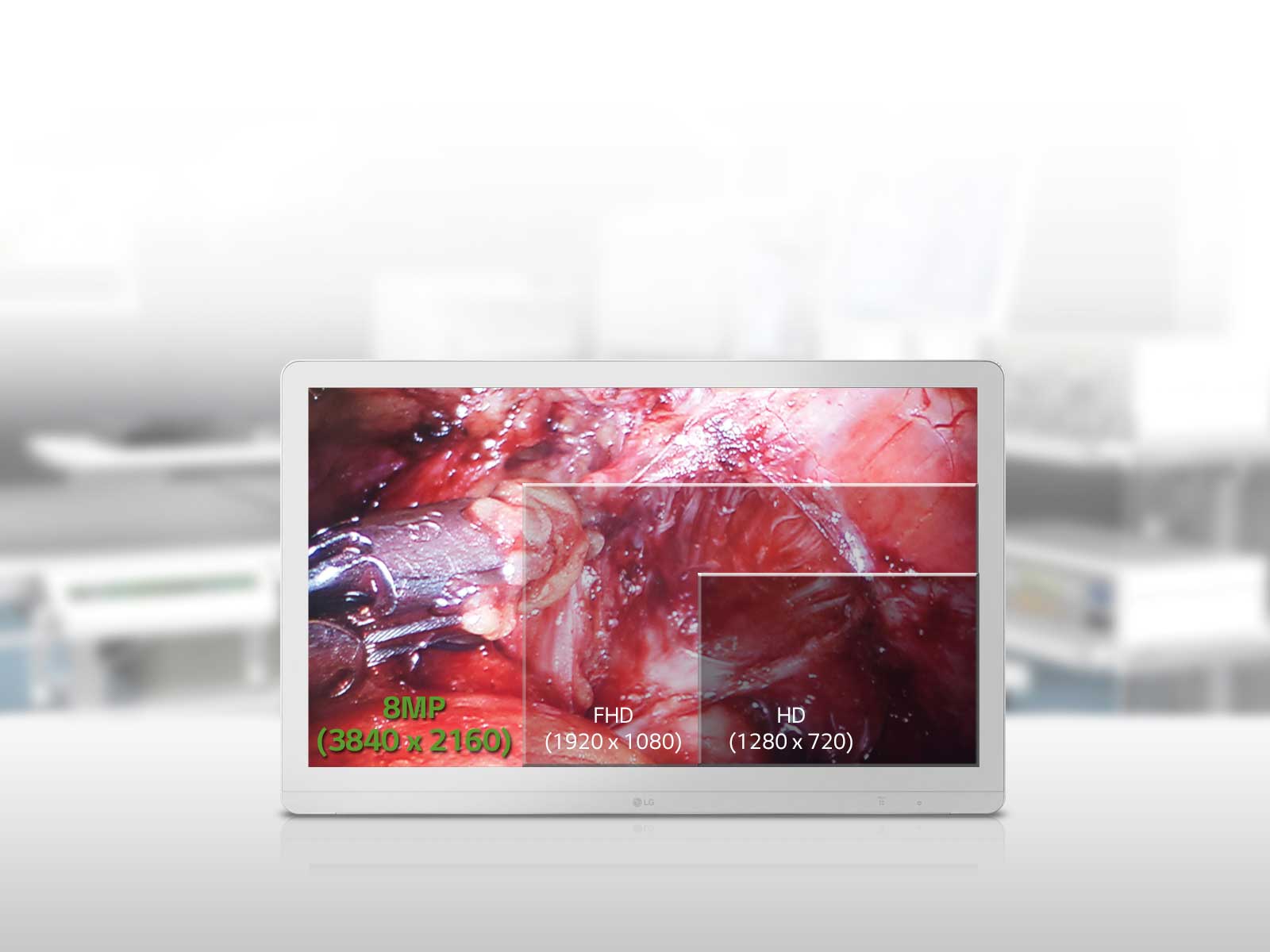 27” IPS 8MP Premium <br>UHD1