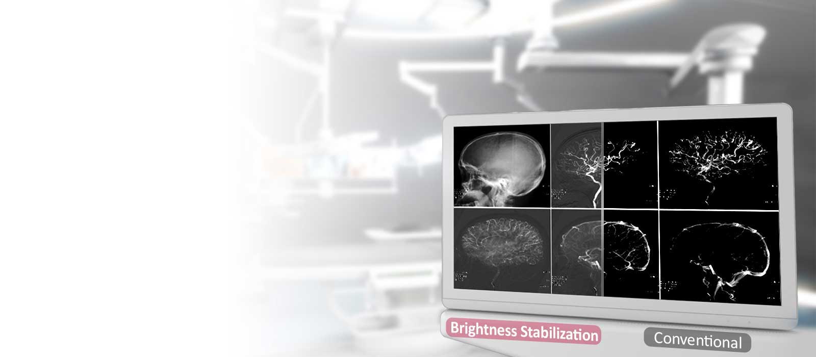 DICOM Del 14 og<br>Stabilisering av lysstyrke1