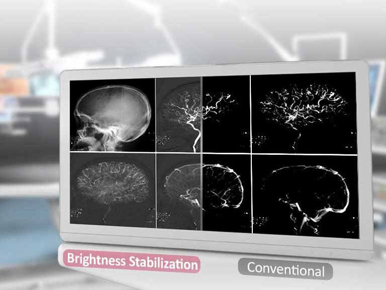 DICOM Del 14 og<br>Stabilisering av lysstyrke2