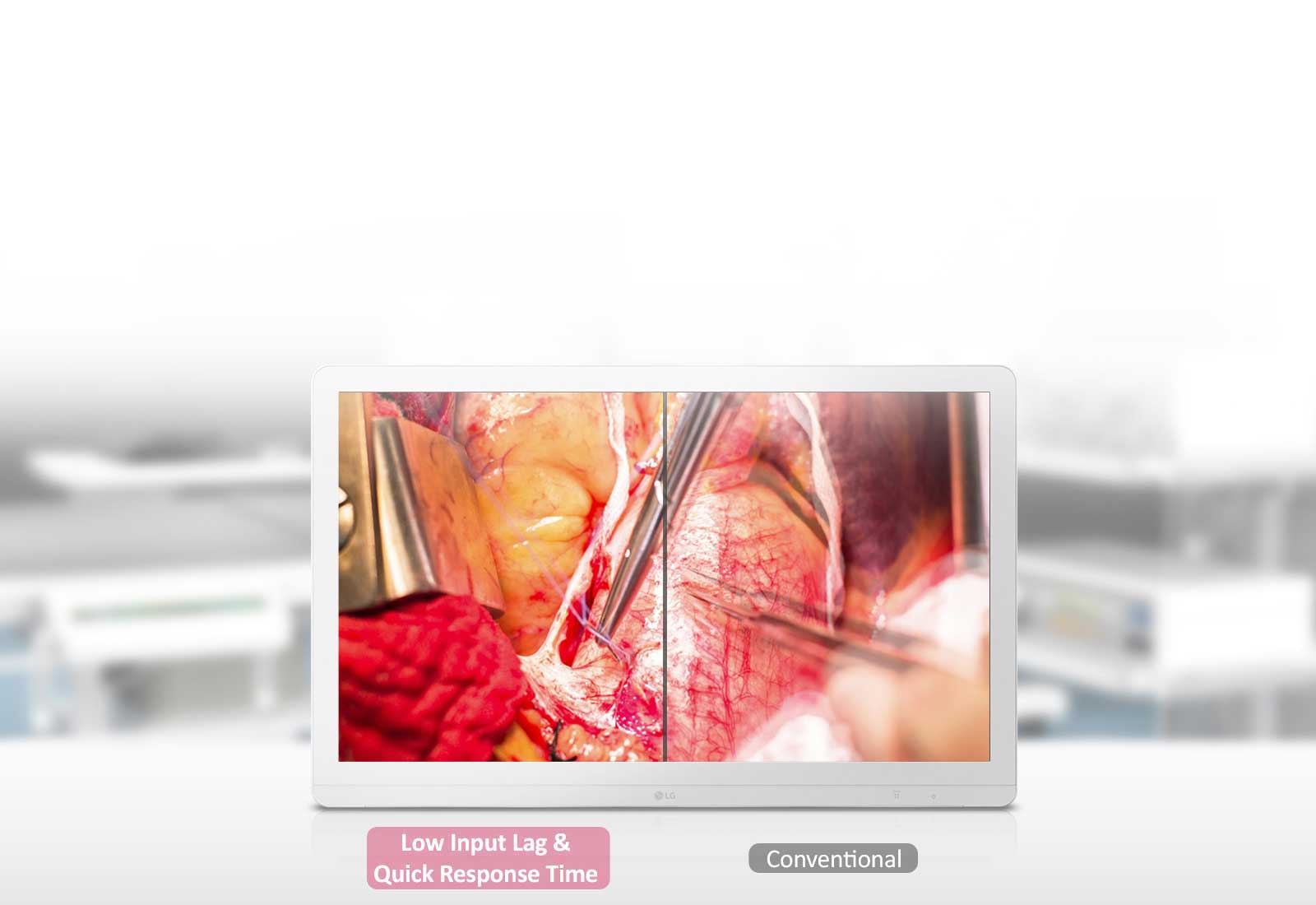 Dynamisk synkroniseringsmodus og hurtigresponstid1