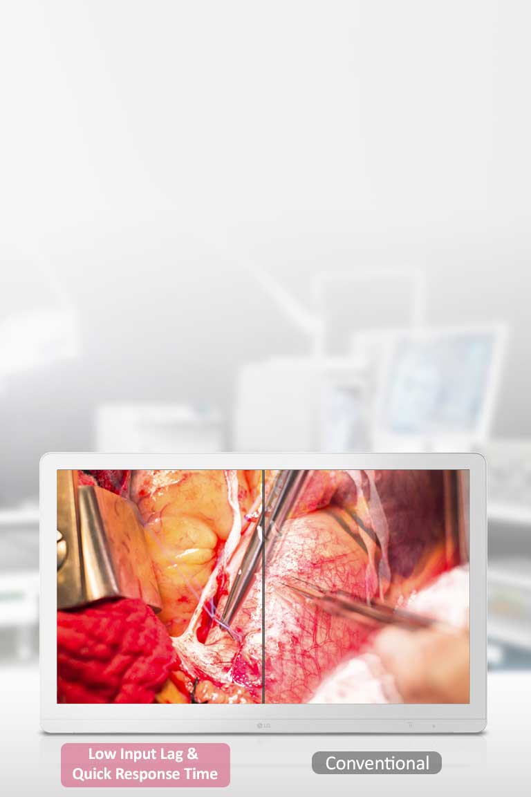 Dynamisk synkroniseringsmodus og hurtigresponstid2